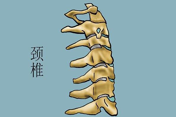 脊髓型颈椎病的症状表现