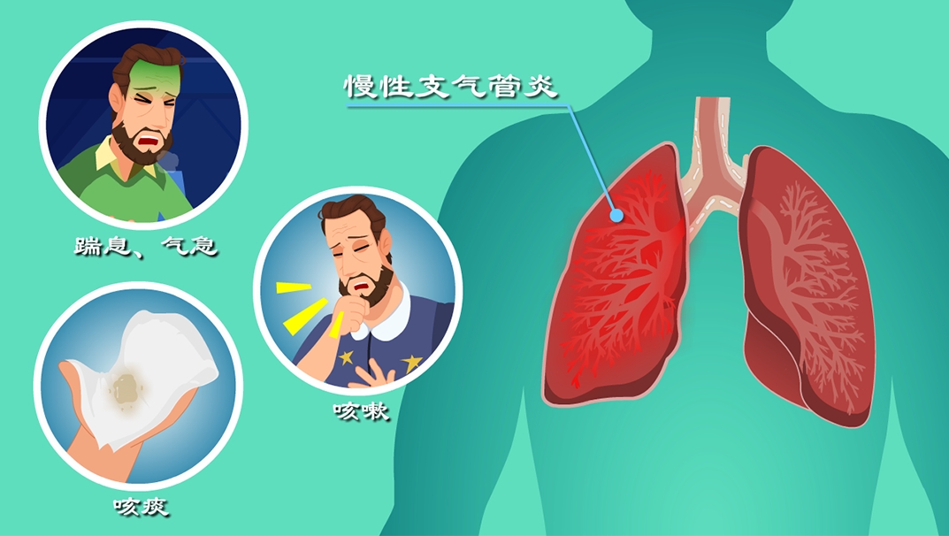 慢性支气管炎的病因